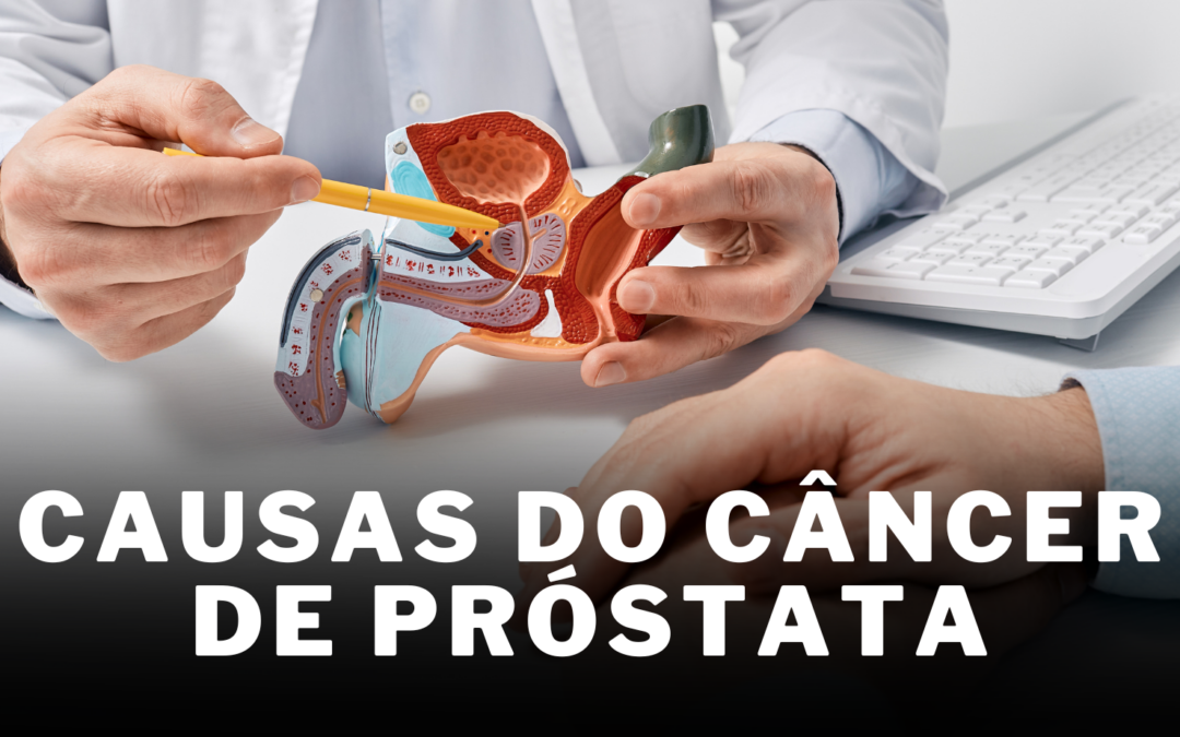 Causas do Câncer de Próstata
